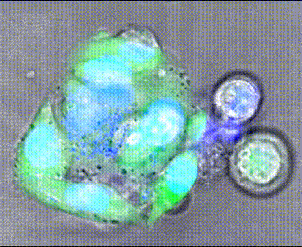 Single cell mass spectroscopy