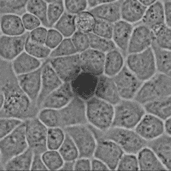 Single cell gene analysis