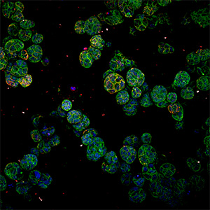 Breast cancer cells under CV8000