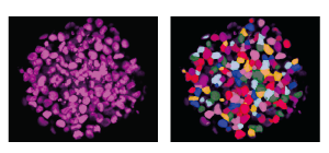 Organoid / Spheroid