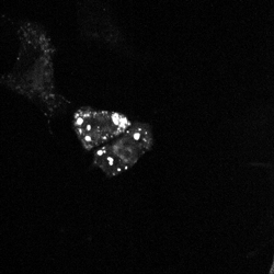 SS2000 細胞内吸引