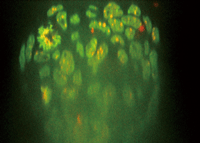 XZ Slice:Conventional