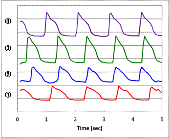 iPSC由来心筋細胞に おける、Ca2+シグナル波形