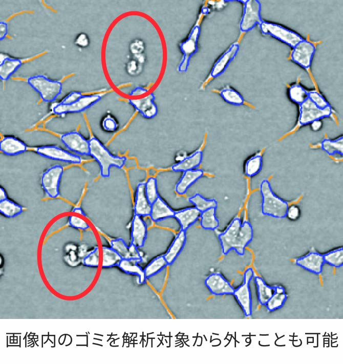 神経突起伸長の評価4