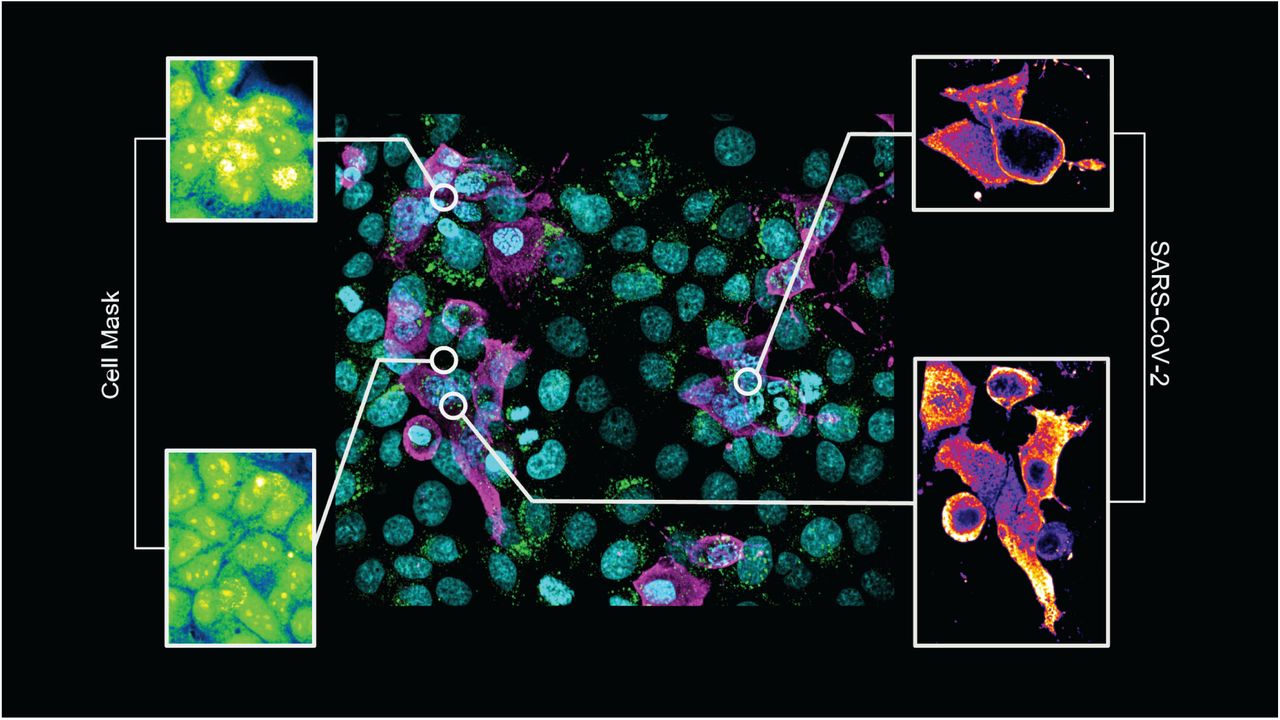SARS-CoV-2 CV8000 image