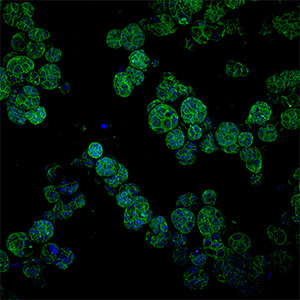 Breast cancer cells under CV8000