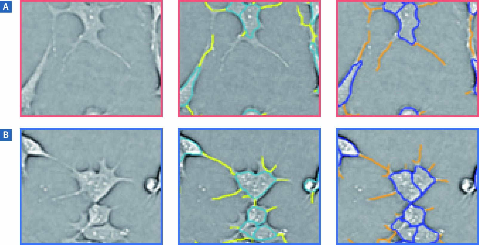 Evaluation of Neurite Outgrowth2