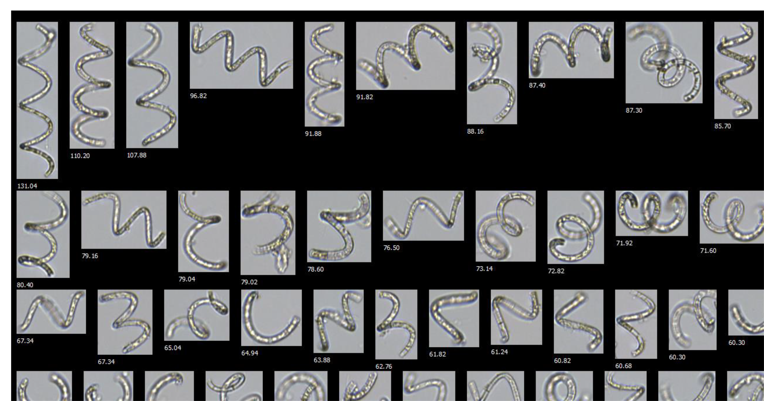 Extract only particles with similar (coiled) morphology