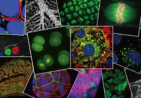 High Content Analysis CellVoyager